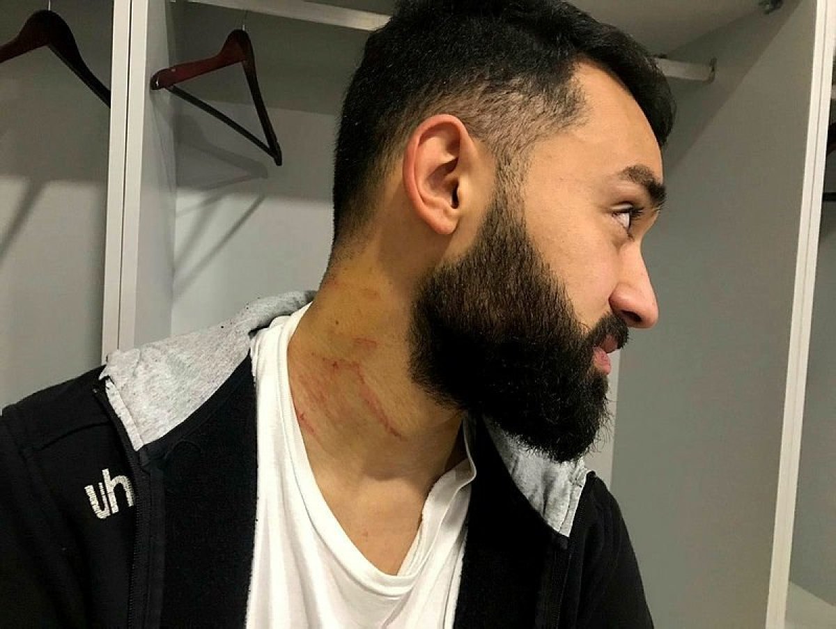 Yaralanan Sakaryasporlu Futbolcu