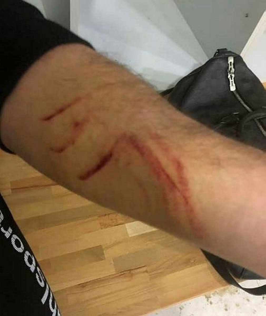 Sakaryasporlu Futbolcunun Kolları